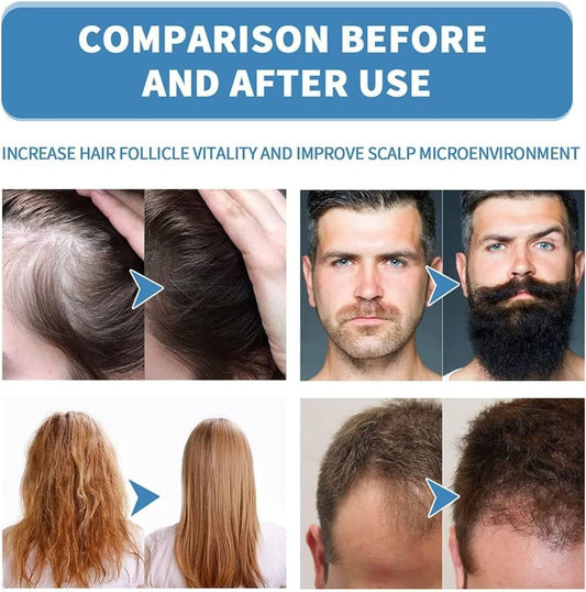 Hair Growth Serum For Women & Men BUY 1 GET 1 FREE