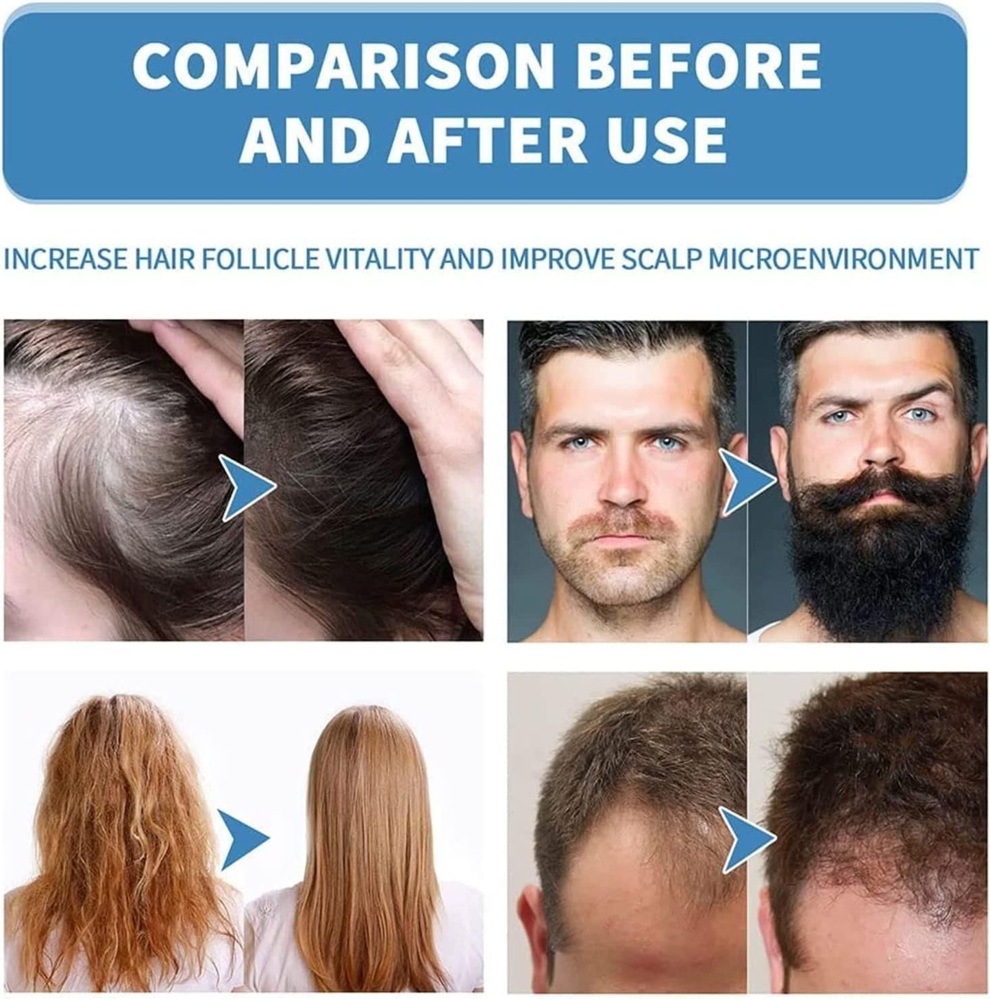 Hair Growth Serum For Women & Men BUY 1 GET 1 FREE